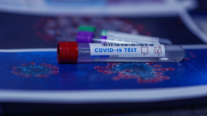 Canary Islands will report Covid cases only twice a week