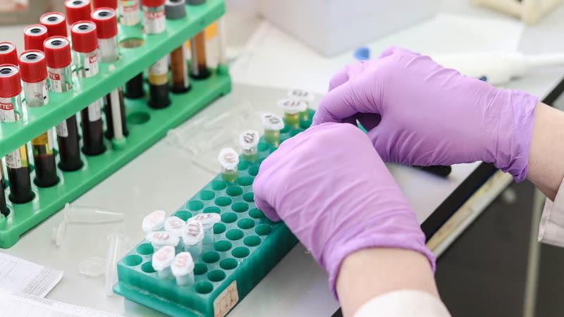 First case of monkeypox in the Canary Islands confirmed in Gran Canaria